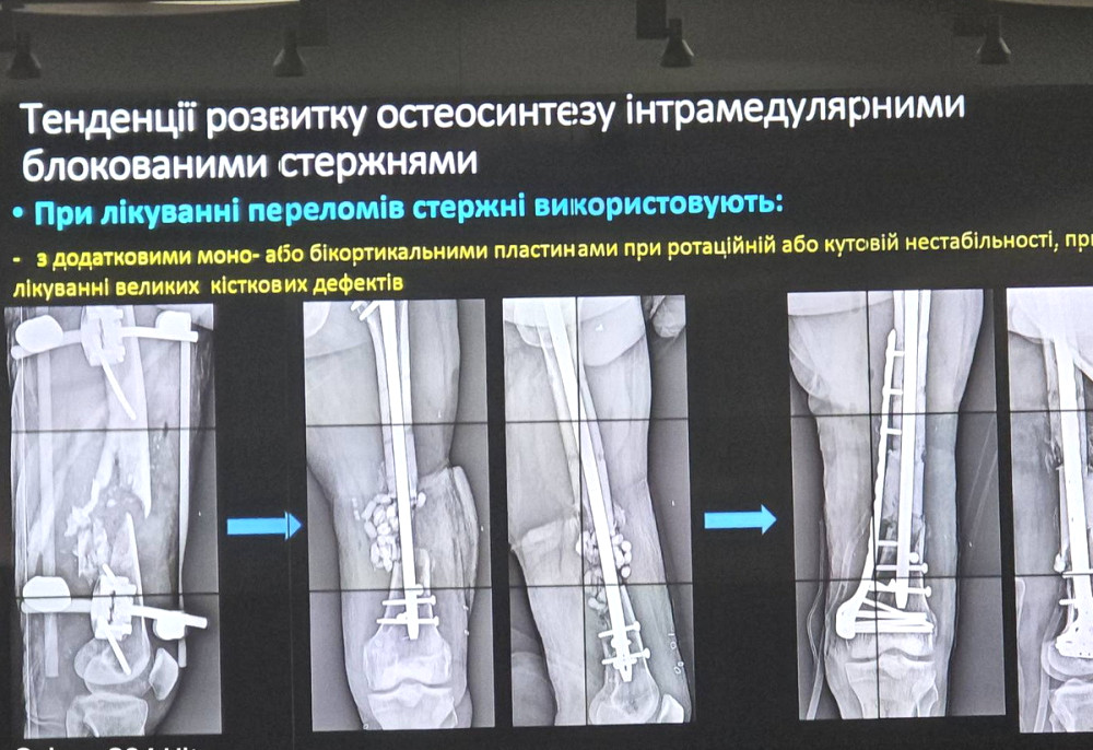 1743 image for slide