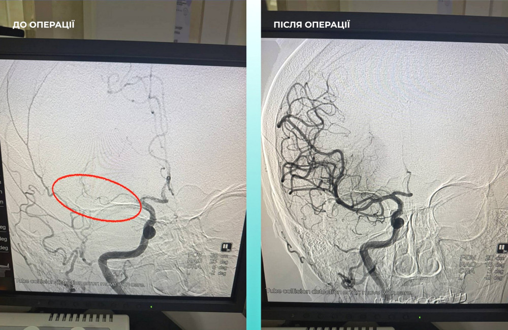 9280 image for slide