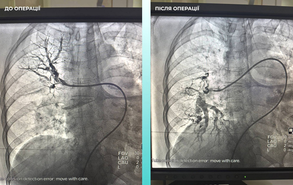 9281 image for slide